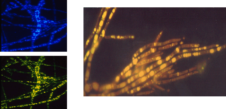 Différentes techniques de microscopie à fluorscence mettant les "vacuoles" en évidence.