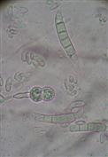 Fusarium solani, en microscopie optique